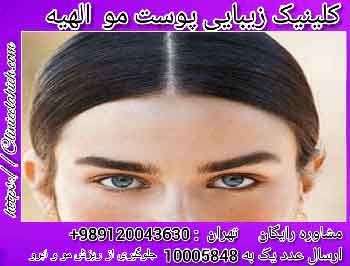 درمان فوری و جلوگیری از ریزش مو و ابرو  1
