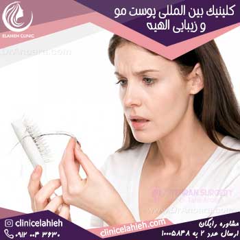 1 مهم‌ترین روش ریزش مو و ابرو راه درمان توسط دکتر علیزاده