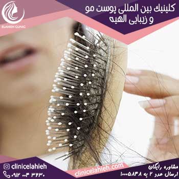 بهترین روش برای جلوگیری از ریزش مو چیست؟ 1