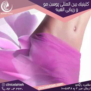 تزریق چربی به واژن در تهران