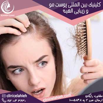 برای همیشه ریزش مو  خود را درمان کنید!