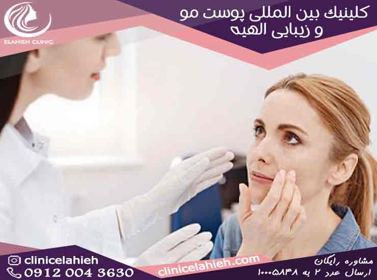 یک پزشک خوب برای زیبایی دکتر علیزاده در تهران