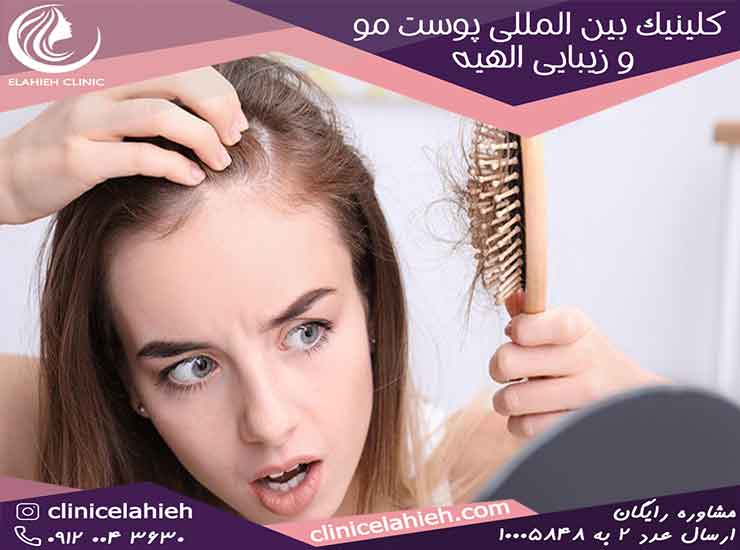 هزینه درمان ریزش قطعی موی بانوان در تهران