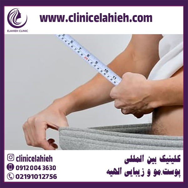 \u0698\u0644 \u0627\u0641\u0632\u0627\u06cc\u0634 \u0633\u0627\u06cc\u0632 \u0622\u0644\u062a \u062a\u0646\u0627\u0633\u0644\u06cc - \u06a9\u0644\u06cc\u0646\u06cc\u06a9 \u0628\u06cc\u0646 \u0627\u0644\u0645\u0644\u0644\u06cc \u067e\u0648\u0633\u062a \u0645\u0648 \u0648 \u0632\u06cc\u0628\u0627\u06cc\u06cc \u0627\u0644\u0647\u06cc\u0647