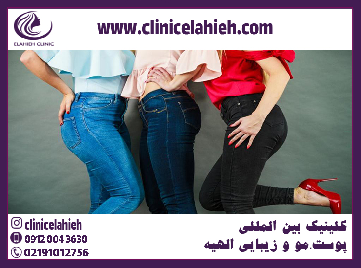 چگونه باسن نرم و ژله ای داشته باشیم؟ - کلینیک بین المللی پوست مو و ...